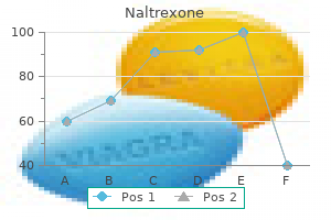 order 50 mg naltrexone otc
