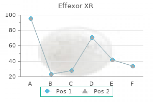 discount 150 mg effexor xr with mastercard