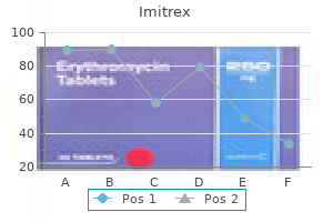 purchase imitrex 100 mg mastercard