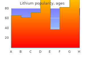 lithium 150 mg order amex