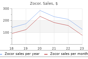 buy cheap zocor 5 mg on line