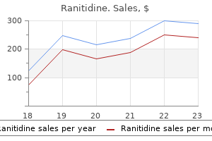 ranitidine 150 mg order online