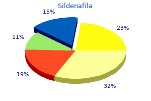 order sildenafila 50 mg mastercard