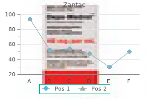purchase 150 mg zantac with mastercard